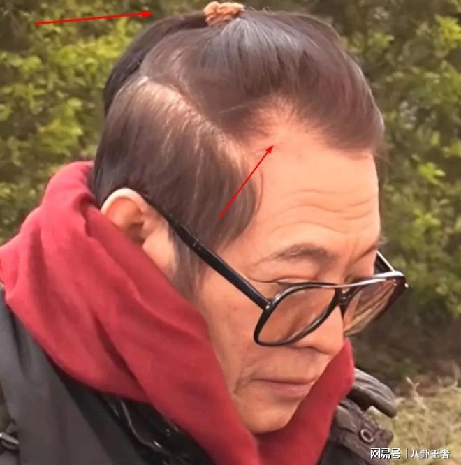 黑斑掉发严重老成80岁憔悴病容令人担忧m6米乐app曝60岁李连杰近照！满脸(图1)