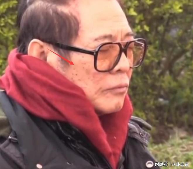 黑斑掉发严重老成80岁憔悴病容令人担忧m6米乐app曝60岁李连杰近照！满脸(图2)