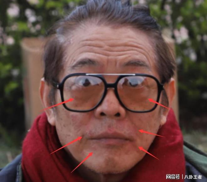 黑斑掉发严重老成80岁憔悴病容令人担忧m6米乐app曝60岁李连杰近照！满脸(图3)